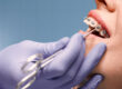 Negligencia Ortodoncia Dentix